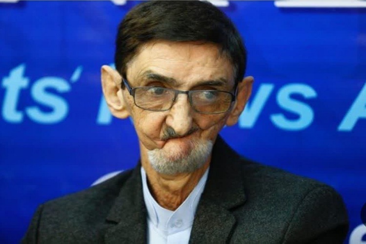 مسعود صاحبی جانباز 70 درصد همدانی