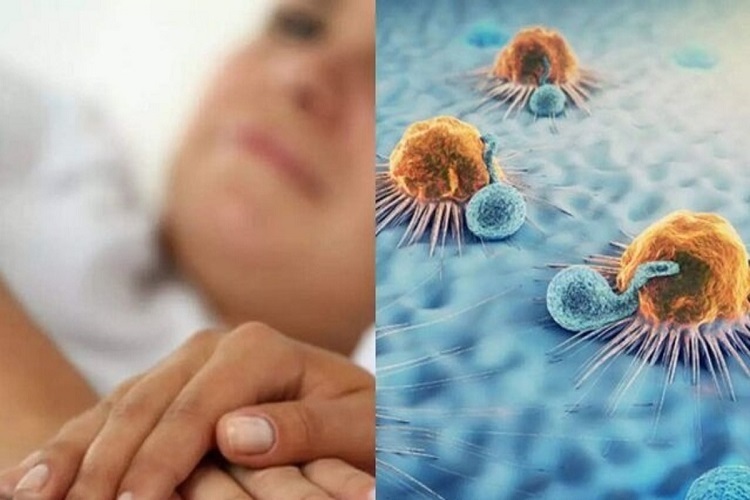 درمان سرطان